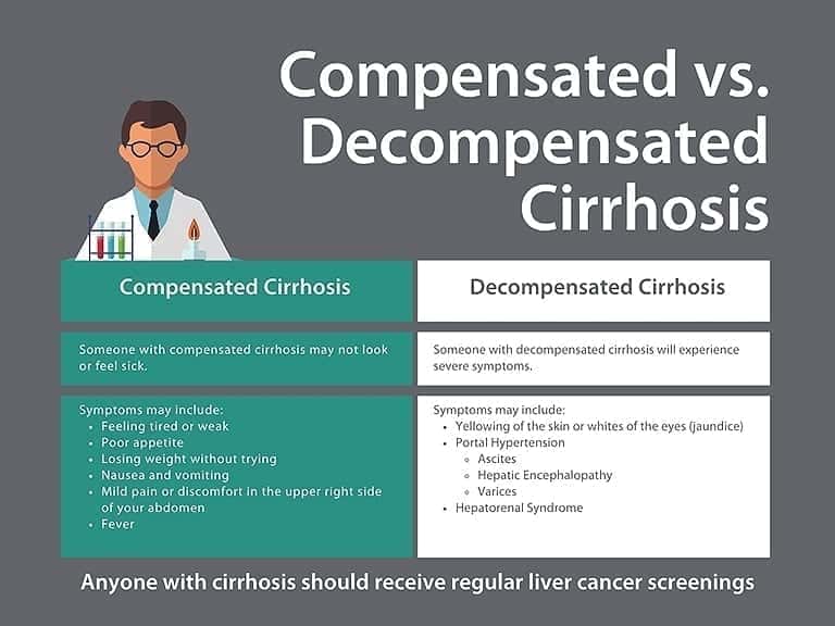 Compensated Cirrhosis