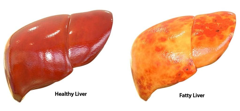 Normal Liver Size and Your Health