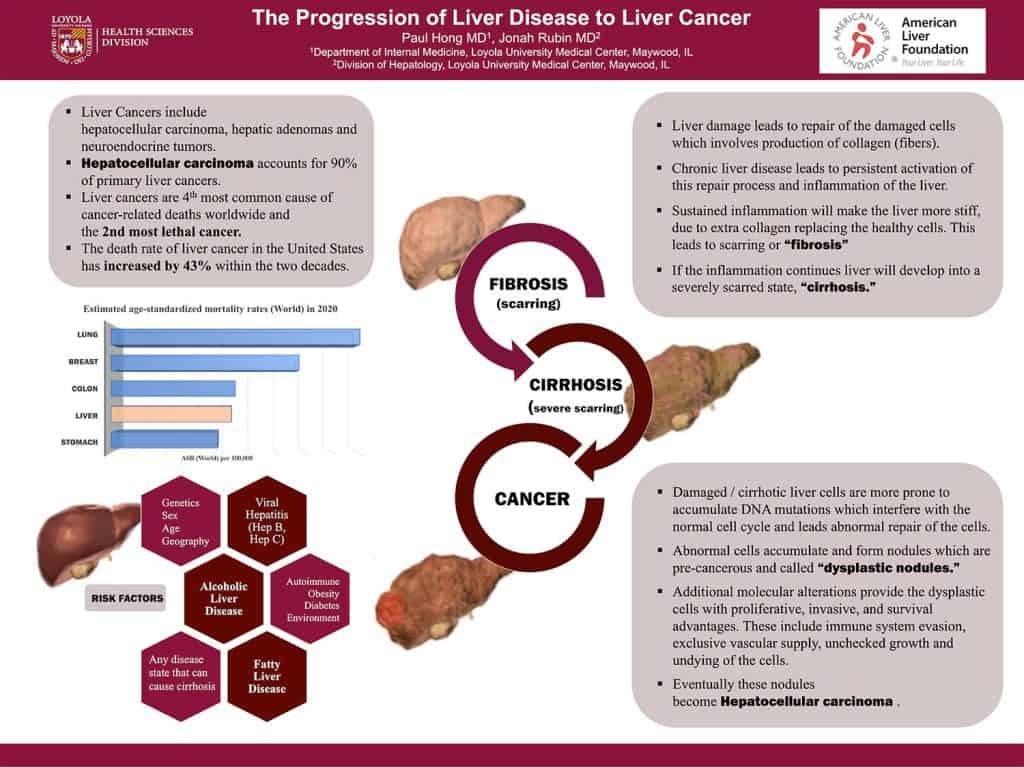 progress of liver disease liver