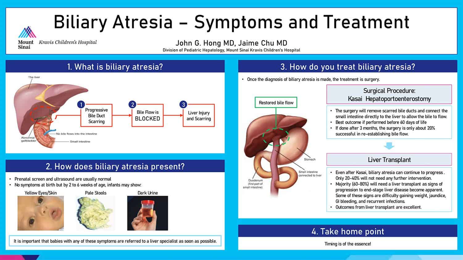 Biliary Atresia – Symptoms And Treatment - American Liver Foundation