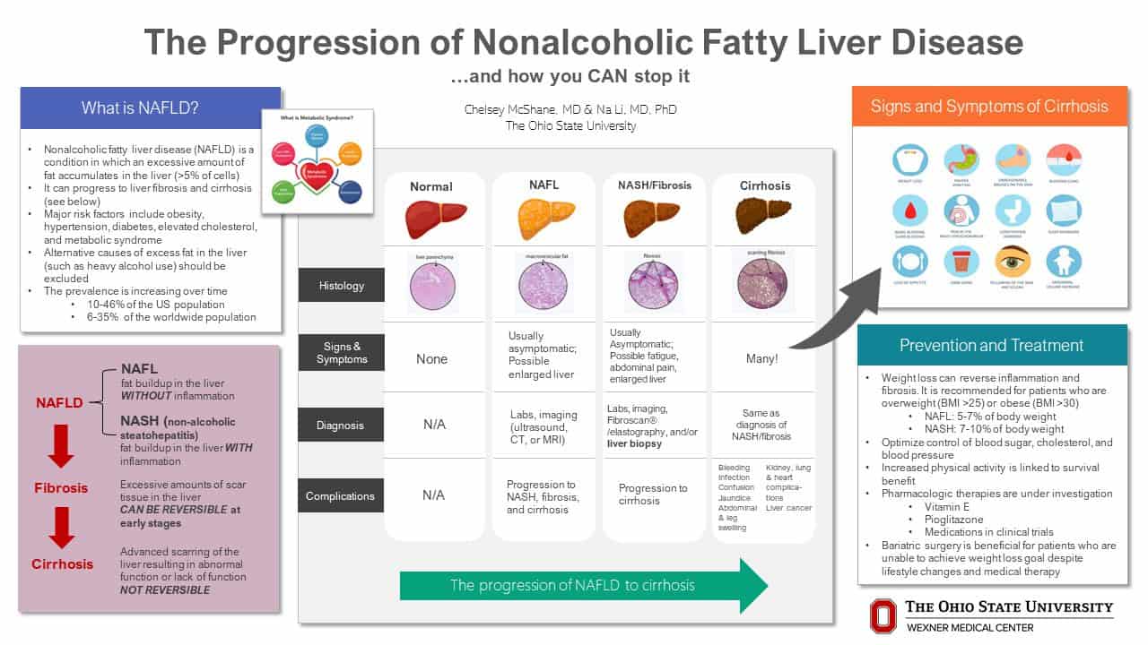 The Progression of Nonalcoholic Fatty Liver Disease…and How You CAN ...