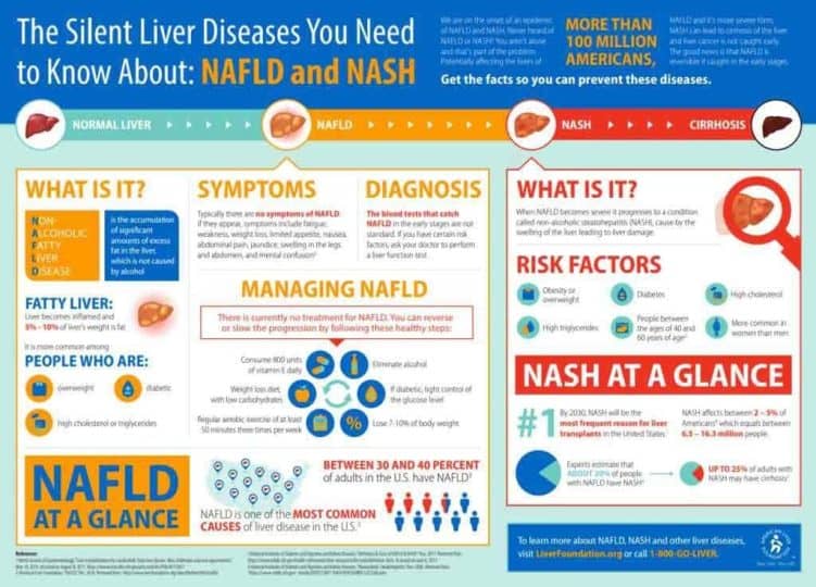 NASH Definition & Progression