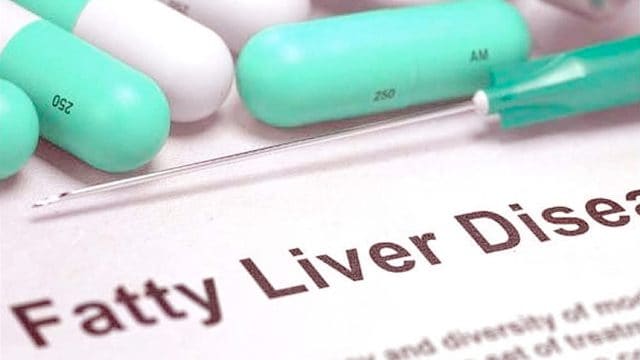 Nonalcoholic Fatty Liver Disease (NAFLD)