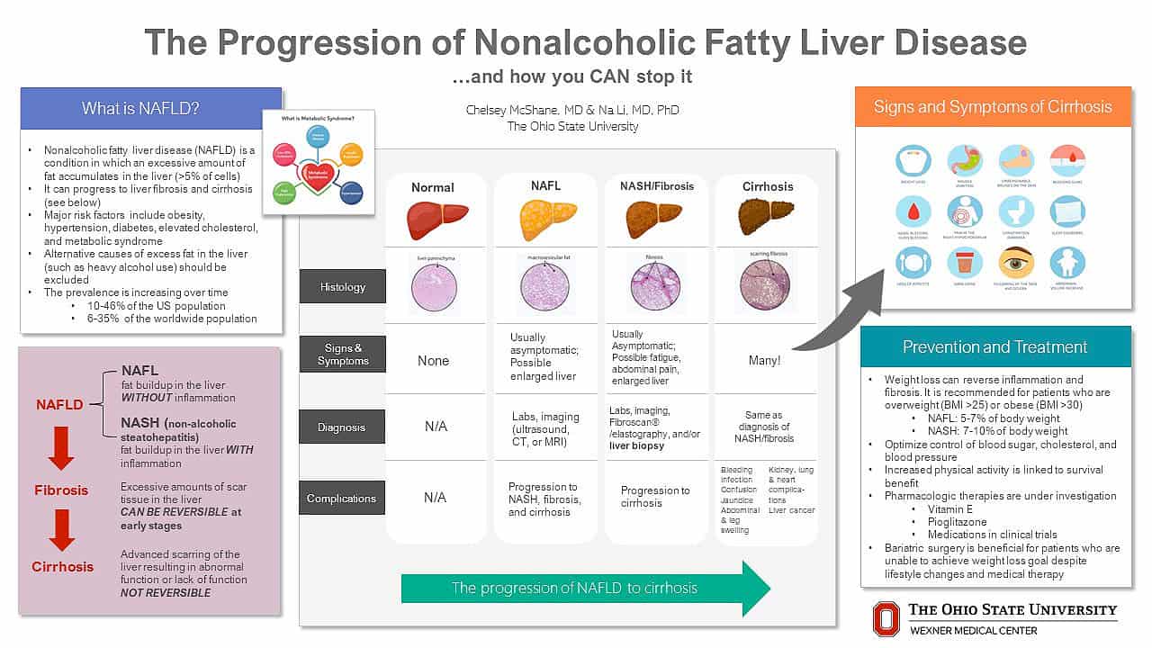 La progresión de la enfermedad del hígado graso no alcohólico ... y cómo puede detenerla