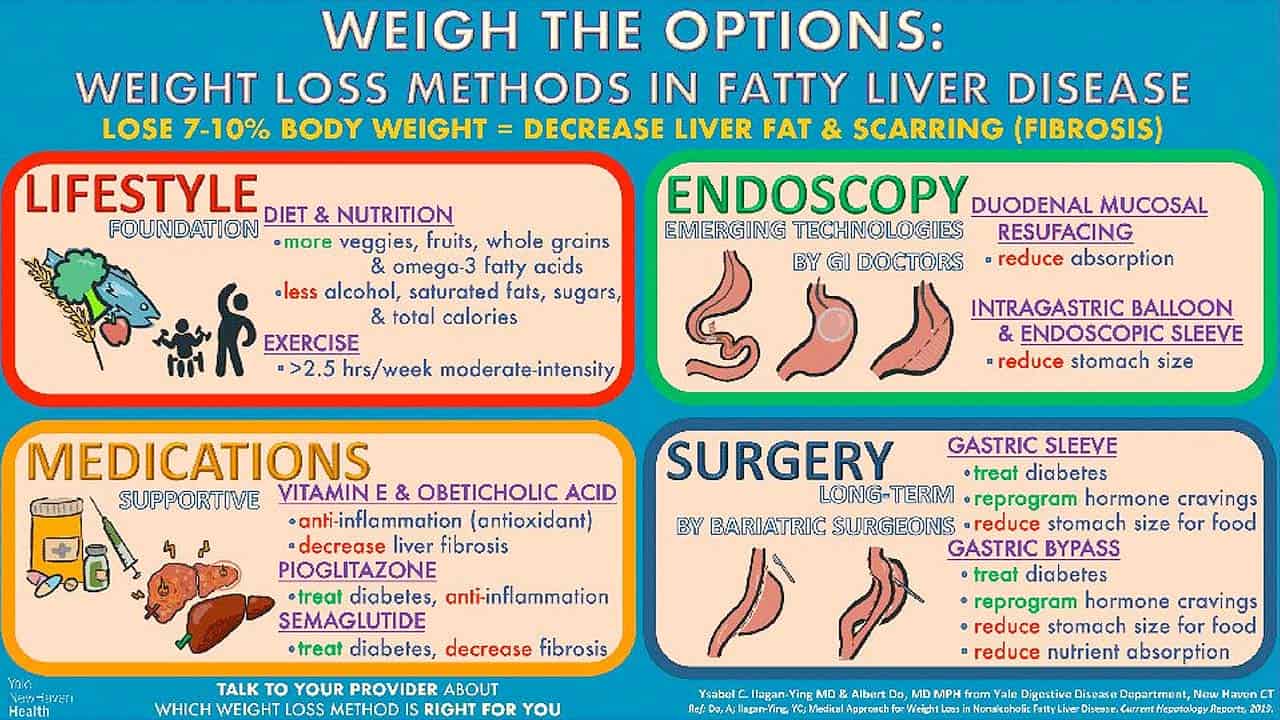 Sopesar las opciones: métodos de pérdida de peso en la enfermedad del hígado graso